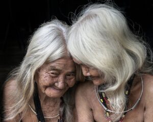 VIO脱毛を始める前に白髪が生えるのを防ぐ方法は？